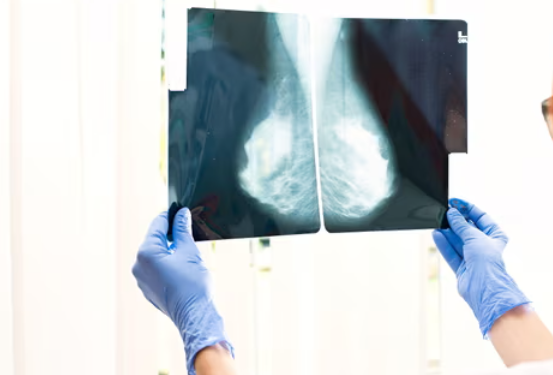 Image Source: Marina Krasnokutska/Alamy