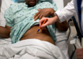 A doctor at Johns Hopkins Hospital labels the kidney to be removed from a living Black donor in this 2012 photo. Brendan Smialowski/AFP/Getty Images/File
