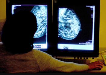 Rui Vieira / Associated Press