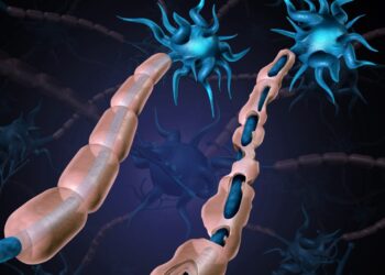 Multiple Sclerosis Damaged Myelin