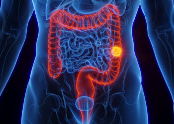 Rep. Watson Coleman introduces resolution calling for increased research in colorectal cancer