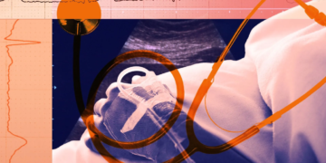 Image Source: Sarah Grillo/Axios