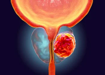 Associating serum testosterone levels with African ancestral prostate cancer health disparities