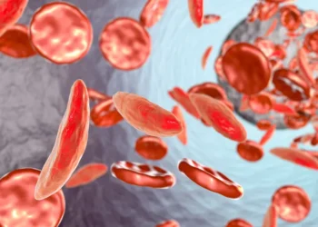 CDC budget ax puts Michigan’s sickle cell lifeline—and Black patients—on the brink