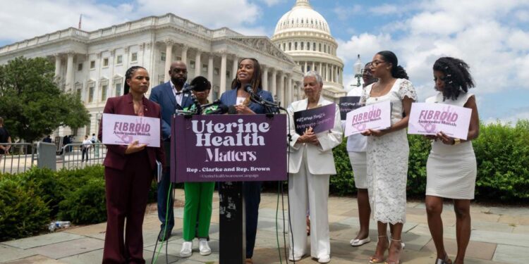 U-FIGHT Act seeks federal investment in research and tracking of uterine fibroids